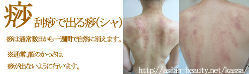 かっさで出るシャ